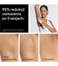 Braun Silk·expert Pro 5 Αποτριχωτική Μηχανή IPL για Πρόσωπο & Μπικίνι PL5210 