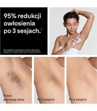  Braun Skin i·expert Σετ Αποτρίχωσης IPL για Πρόσωπο, Σώμα & Μπικίνι PL7321 
